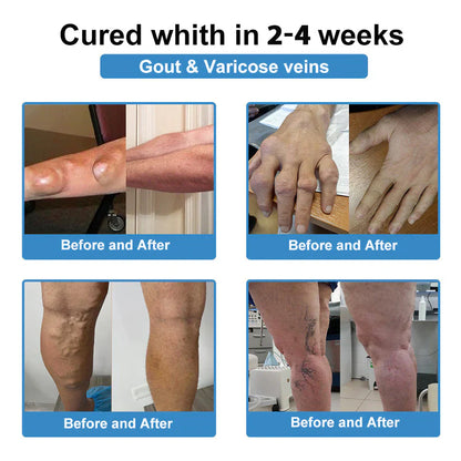 🔥Final 3 Hours: 80% OFF - Official Store: 👩‍⚕️ Recommended by AAOS 💪 ODALIT® Nano Microneedle Joint Patch (Painless, long-lasting, suitable for arthritis, varicose veins and various orthopedic diseases)