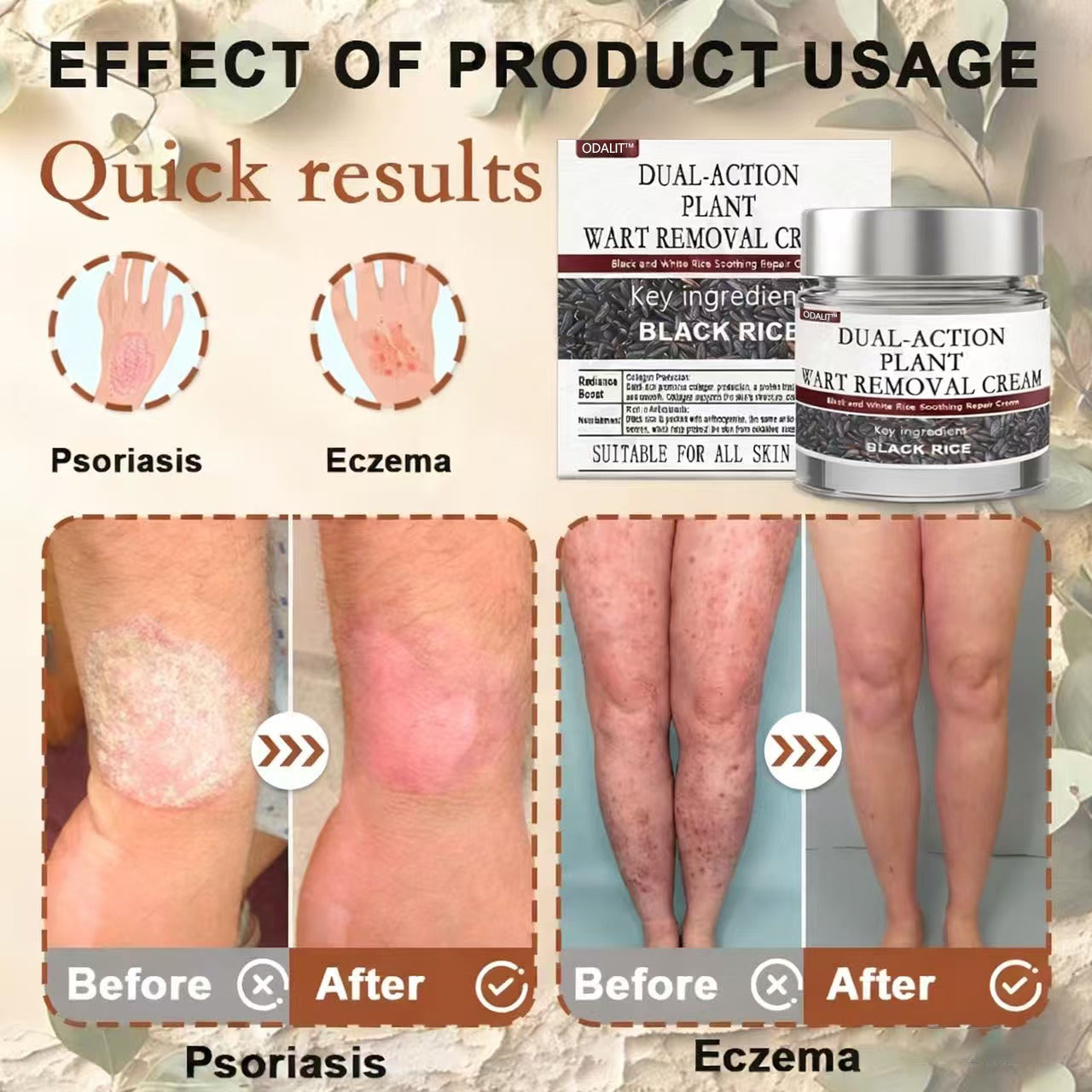 🎁ODALIT™ Black Rice Skin Repair Essence Cream ⚕️ FDA Certified (Removes warts and skin growths, improves keratin buildup and seborrheic dermatitis, follicular keratosis, age spots, and bruising)