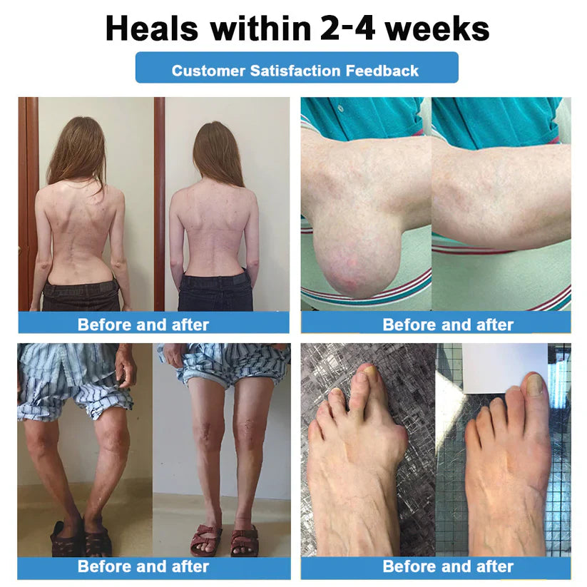 🔥Final 3 Hours: 80% OFF - Official Store: 👩‍⚕️ Recommended by AAOS 💪 ODALIT® Nano Microneedle Joint Patch (Painless, long-lasting, suitable for arthritis, varicose veins and various orthopedic diseases)