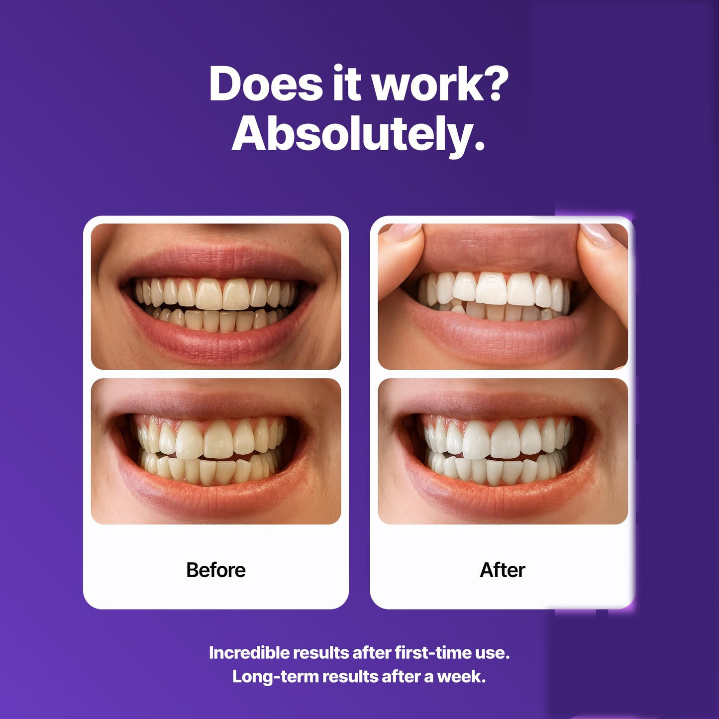 Purple Whitening Strips - 🟣 🟡Experience a Brighter, Whiter Smile with Our New PAP-Enhanced Purple Teeth Whitening Strips