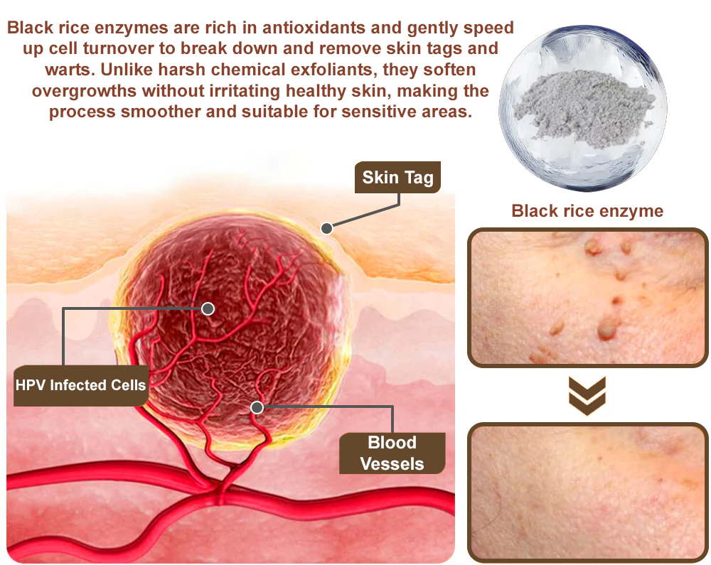 🎁ODALIT™ Black Rice Skin Repair Essence Cream ⚕️ FDA Certified (Removes warts and skin growths, improves keratin buildup and seborrheic dermatitis, follicular keratosis, age spots, and bruising)