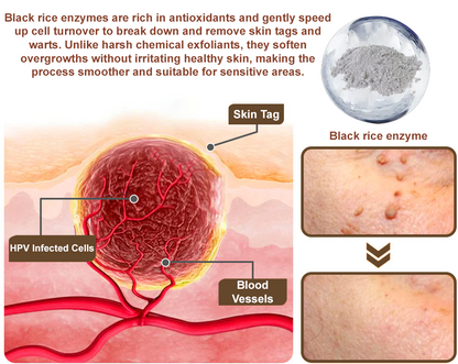 🎁ODALIT™ Black Rice Skin Repair Essence Cream ⚕️ FDA Certified (Removes warts and skin growths, improves keratin buildup and seborrheic dermatitis, follicular keratosis, age spots, and bruising)