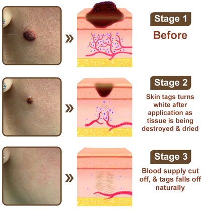 🎁ODALIT™ Black Rice Skin Repair Essence Cream ⚕️ FDA Certified (Removes warts and skin growths, improves keratin buildup and seborrheic dermatitis, follicular keratosis, age spots, and bruising)