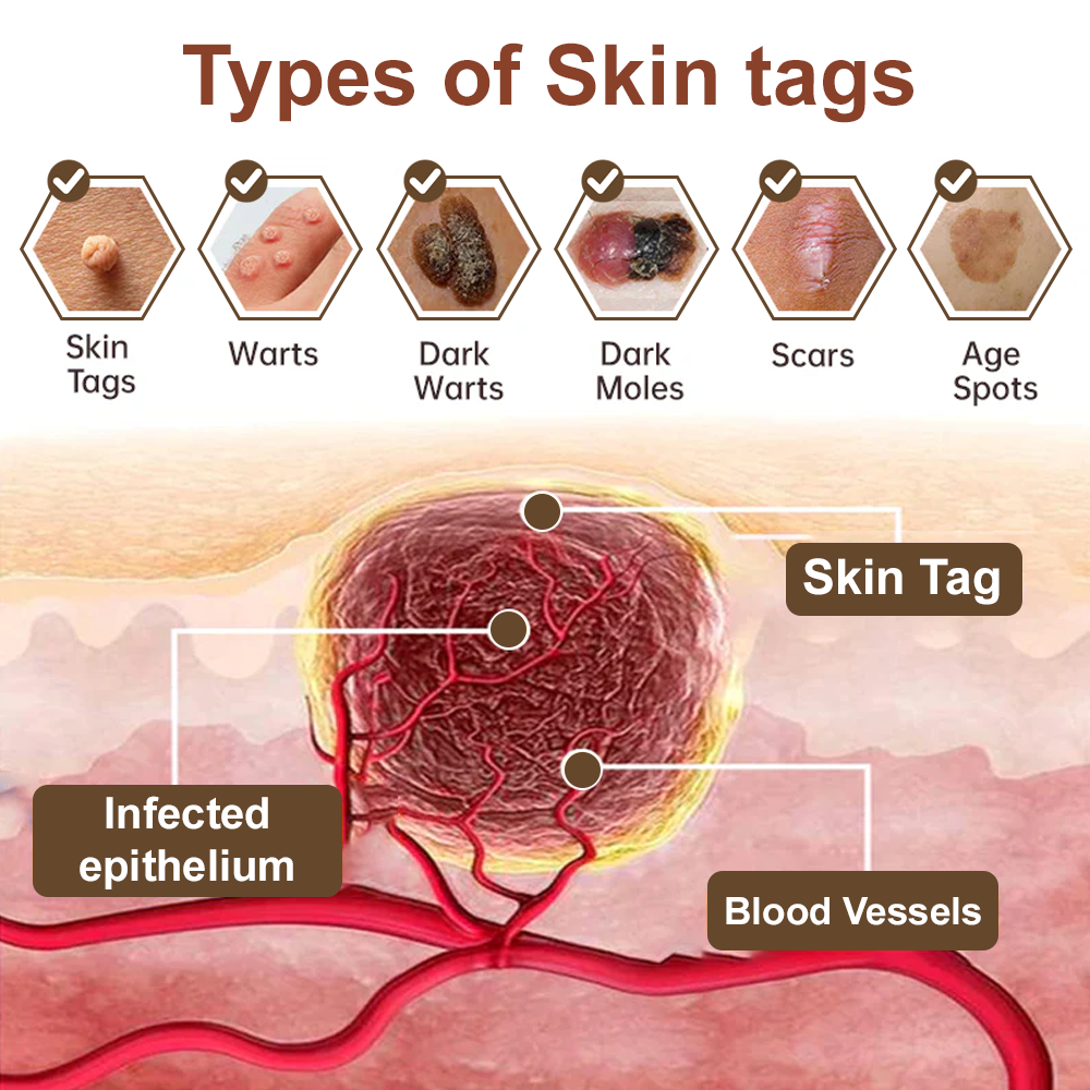 🎁ODALIT™ Black Rice Skin Repair Essence Cream ⚕️ FDA Certified (Removes warts and skin growths, improves keratin buildup and seborrheic dermatitis, follicular keratosis, age spots, and bruising)