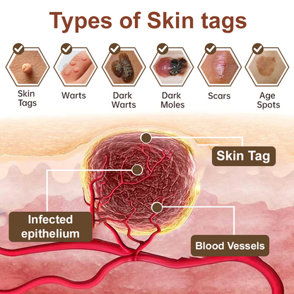 🎁ODALIT™ Black Rice Skin Repair Essence Cream ⚕️ FDA Certified (Removes warts and skin growths, improves keratin buildup and seborrheic dermatitis, follicular keratosis, age spots, and bruising)